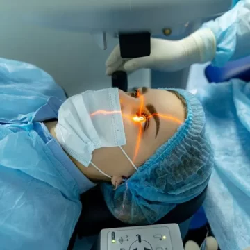 Understanding SILK Eye Surgery: A Flapless Laser Technique for Clear Vision